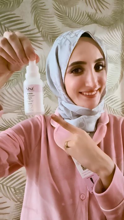 Merve Ö. - İstanbul influencer